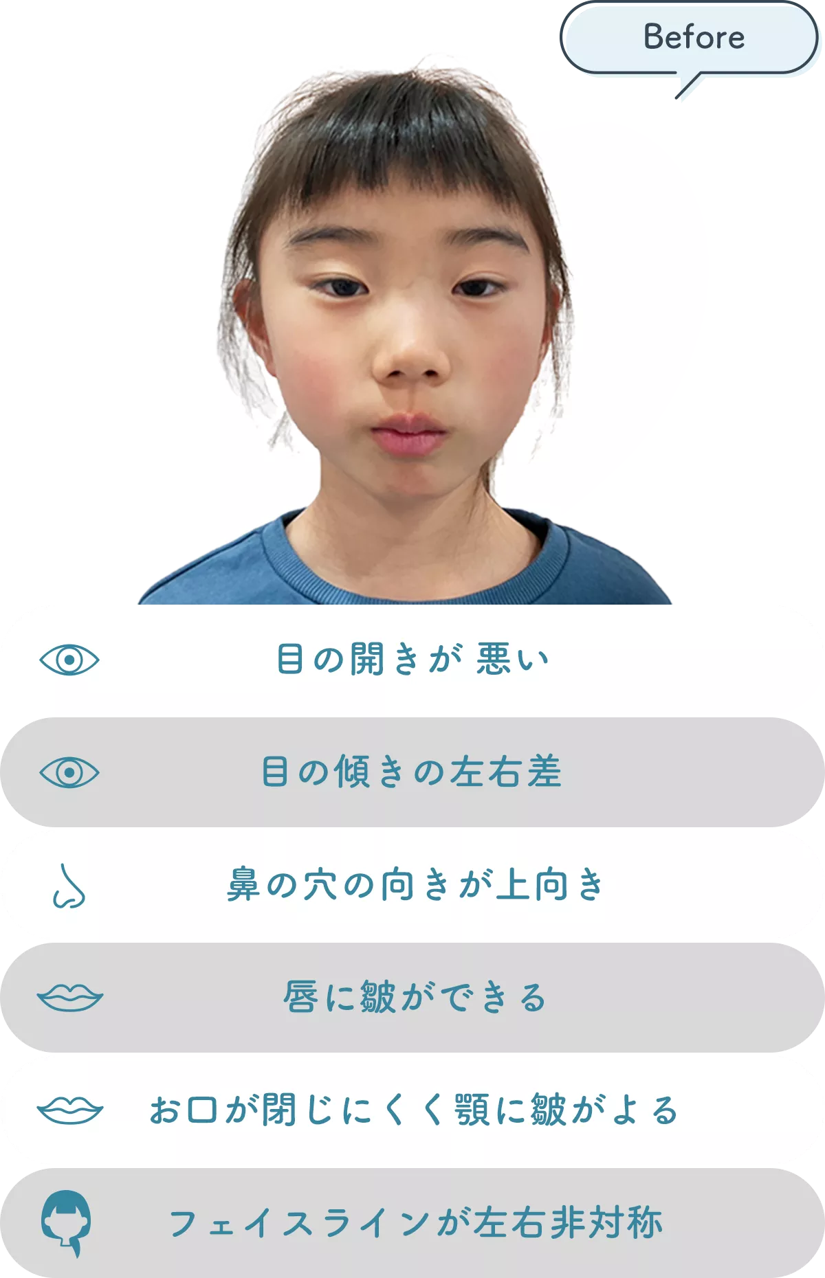 facial