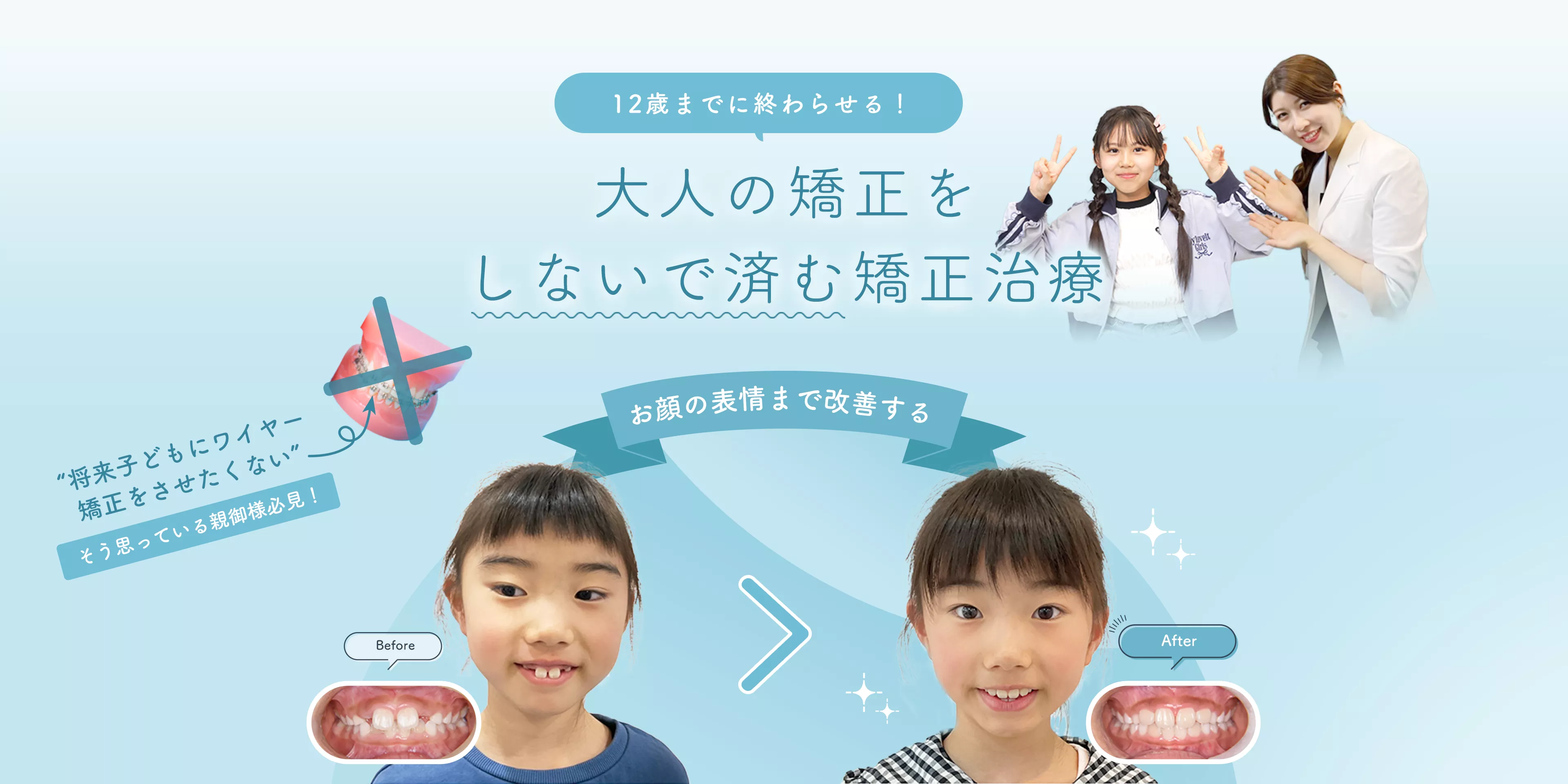 オンライン矯正ならPureteth